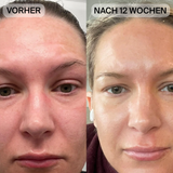 Natural Botulin LED-Infrarot-Maske